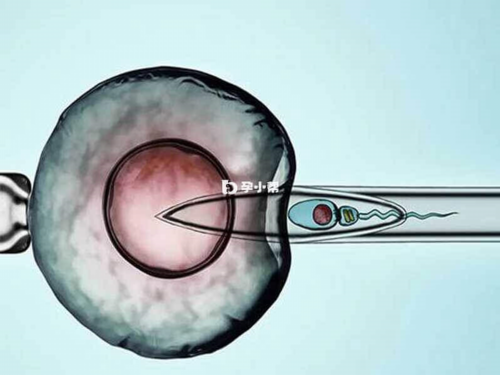 2026北京借卵三代试管婴儿医院成功率排名？,供卵代孕费用多少钱