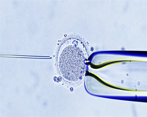 <b>女人借卵子做试管费用大概要多少钱？,助孕代怀官网</b>